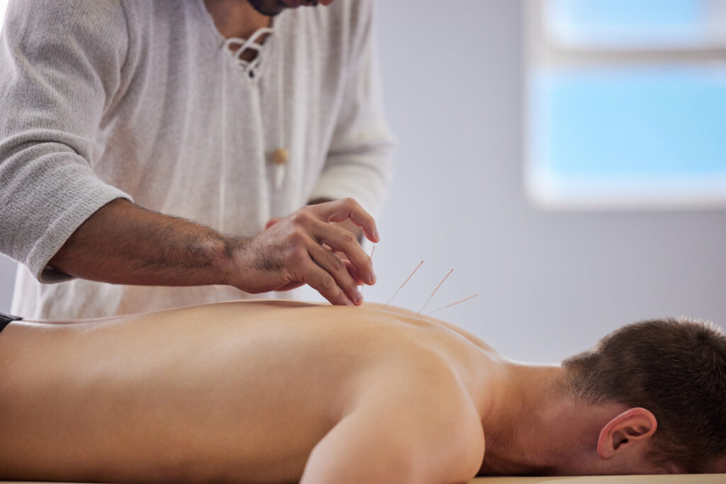 ive never felt more relaxed shot of a acupuncturi 2025 04 05 15 49 24 utc